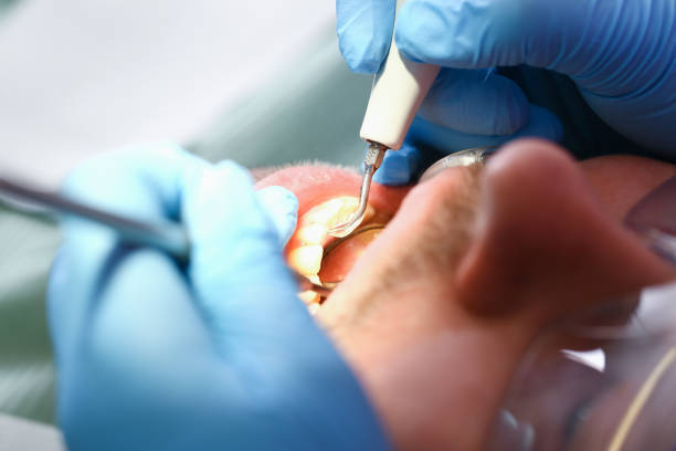 Best Emergency Treatment for Toothache in Wheeler, TX