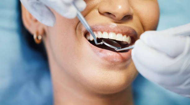 Best Walk-In Emergency Dentist in Wheeler, TX
